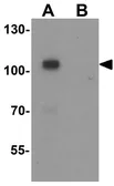 Anti-CASK antibody used in Western Blot (WB). GTX31858