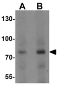 Anti-KEAP1 antibody used in Western Blot (WB). GTX31864