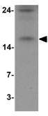 Anti-BATF antibody used in Western Blot (WB). GTX31865