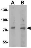 Anti-JAKMIP1 antibody used in Western Blot (WB). GTX31867