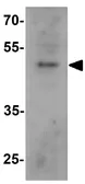 Anti-BCL3 antibody used in Western Blot (WB). GTX31868