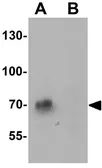 Anti-STAT3 antibody used in Western Blot (WB). GTX31870