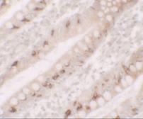 Anti-Anterior Gradient 2 antibody used in IHC (Paraffin sections) (IHC-P). GTX31873