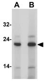 Anti-Anterior Gradient 2 antibody used in Western Blot (WB). GTX31873