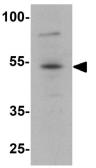 Anti-FOXA1 antibody used in Western Blot (WB). GTX31874