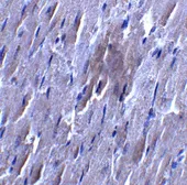 Anti-SLC27A6 antibody used in IHC (Paraffin sections) (IHC-P). GTX31878