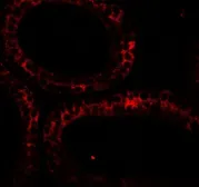 Anti-DIS3 antibody used in IHC (Paraffin sections) (IHC-P). GTX31880