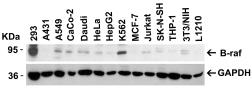 Anti-B-Raf antibody used in Western Blot (WB). GTX31881