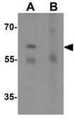 Anti-Estrogen Receptor alpha antibody used in Western Blot (WB). GTX31883
