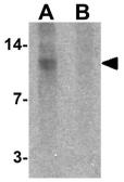 Anti-beta 2 Microglobulin antibody used in Western Blot (WB). GTX31884