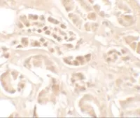 Anti-Kallikrein 4 antibody used in IHC (Paraffin sections) (IHC-P). GTX31887