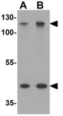Anti-MUC1 antibody used in Western Blot (WB). GTX31889