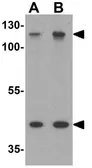 Anti-MUC1 antibody used in Western Blot (WB). GTX31889