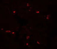 Anti-CD272 antibody used in IHC (Paraffin sections) (IHC-P). GTX31892