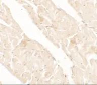Anti-AIMP2 antibody used in IHC (Paraffin sections) (IHC-P). GTX31896