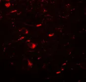 Anti-LC3B antibody used in IHC (Paraffin sections) (IHC-P). GTX31899