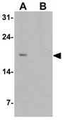 Anti-SDF1 antibody used in Western Blot (WB). GTX31900