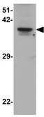 Anti-THAP11 antibody used in Western Blot (WB). GTX31903