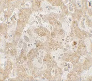 Anti-CCR7 antibody used in IHC (Paraffin sections) (IHC-P). GTX31906