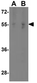 Anti-SPNS1 antibody used in Western Blot (WB). GTX31907