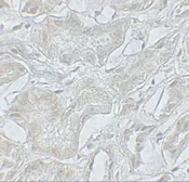 Anti-ARF6 antibody used in IHC (Paraffin sections) (IHC-P). GTX31908