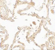 Anti-SUZ12 antibody used in IHC (Paraffin sections) (IHC-P). GTX31909