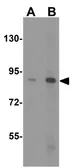 Anti-PGC1 alpha antibody used in Western Blot (WB). GTX31910