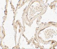 Anti-HMGB1 antibody used in IHC (Paraffin sections) (IHC-P). GTX31912