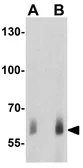 Anti-ME2 antibody used in Western Blot (WB). GTX31915