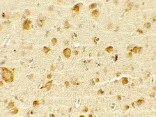 Anti-OLIG1 antibody used in IHC (Paraffin sections) (IHC-P). GTX31916