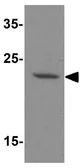 Anti-DENR antibody used in Western Blot (WB). GTX31918