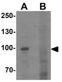Anti-PGC1 alpha antibody used in Western Blot (WB). GTX31921
