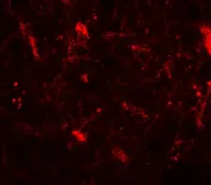 Anti-CRF antibody used in IHC (Paraffin sections) (IHC-P). GTX31922