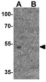 Anti-HDAC1 antibody used in Western Blot (WB). GTX31924