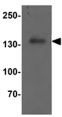 Anti-HDAC6 antibody used in Western Blot (WB). GTX31926