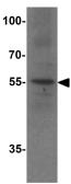Anti-Parkin antibody used in Western Blot (WB). GTX31927