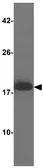 Anti-alpha Synuclein antibody used in Western Blot (WB). GTX31928