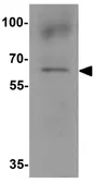 Anti-NOX1 antibody used in Western Blot (WB). GTX31929