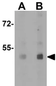 Anti-CD55 antibody used in Western Blot (WB). GTX31932
