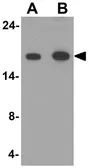 Anti-LC3A antibody used in Western Blot (WB). GTX31934