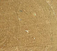 Anti-STEP / PTPN5 antibody used in IHC (Paraffin sections) (IHC-P). GTX31937