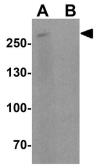 Anti-Cav3.2 antibody used in Western Blot (WB). GTX31939