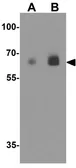 Anti-EPLIN antibody used in Western Blot (WB). GTX31940