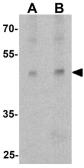 Anti-ATG4A antibody used in Western Blot (WB). GTX31941