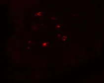 Anti-CTHRC1 antibody used in IHC (Paraffin sections) (IHC-P). GTX31944