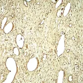 Anti-SLC29A1 antibody used in IHC (Paraffin sections) (IHC-P). GTX31946