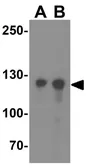 Anti-RFX1 antibody used in Western Blot (WB). GTX31948