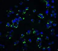 Anti-KIR2DS2 antibody used in Immunocytochemistry/ Immunofluorescence (ICC/IF). GTX31949
