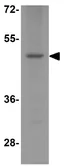 Anti-EDG5 antibody used in Western Blot (WB). GTX31951