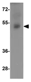 Anti-IZUMO1 antibody used in Western Blot (WB). GTX31952